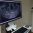 3D Pano Dental Xray Viewer